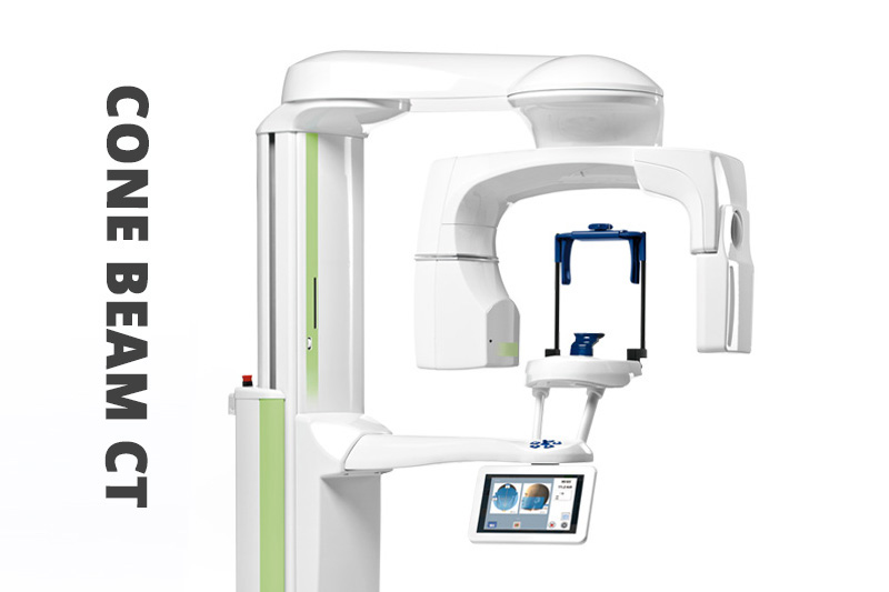 Cone Beam CT Imaging in Apex