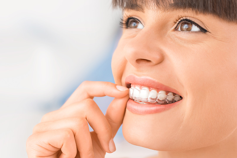 Invisalign in Apex
