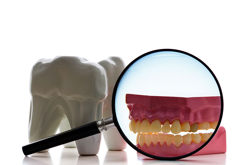 Root Canal Treatment in Apex