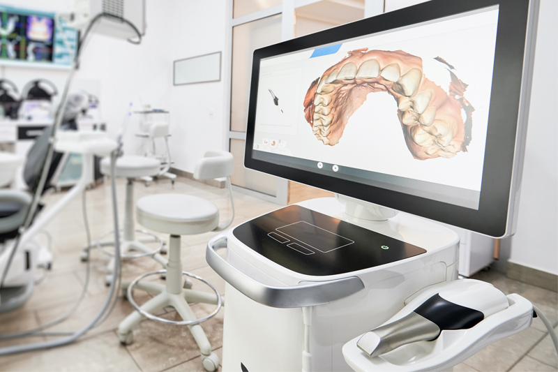 Intra-Oral Scanner in Apex
